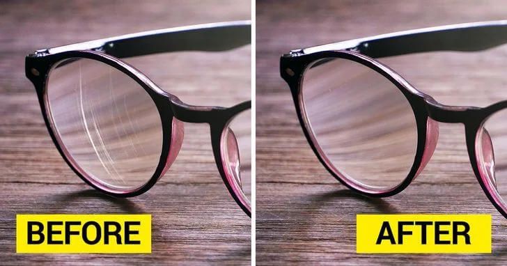 Bác sĩ khuyên gì khi tròng kính bị xước